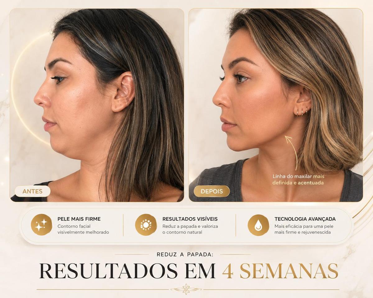 Antes e Depois LUMEV